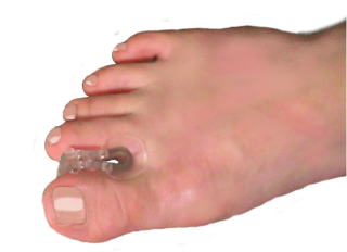 フィットパッド装着により足指が開く