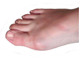 フィットパッド装着前